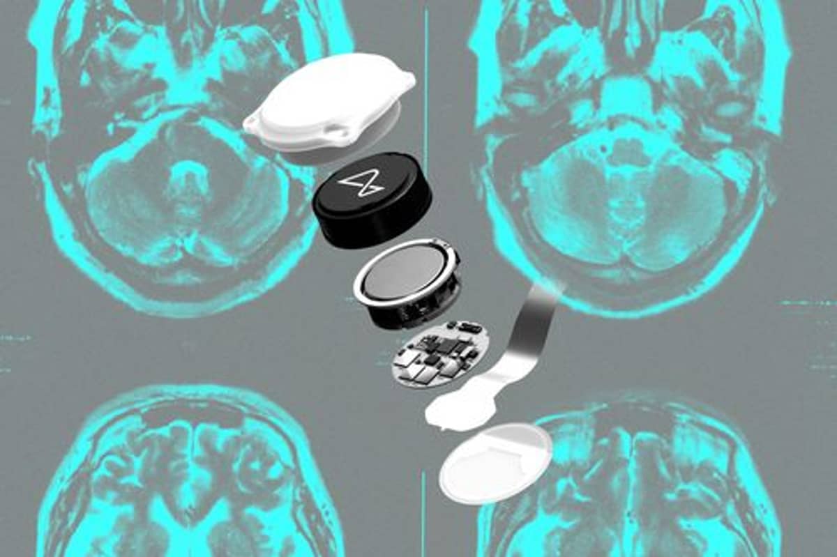 Neuralink's BCI Bet Hits Reality Wall as Musk's Vision Stalls